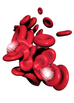 Illustration for article titled What Are The Symptoms Of Varicose Veins And How Are They Treated?